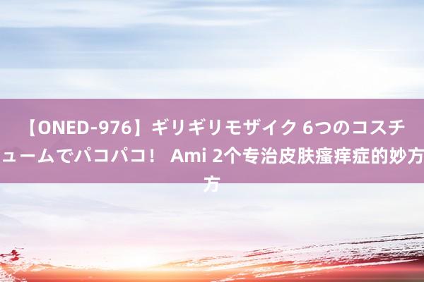 【ONED-976】ギリギリモザイク 6つのコスチュームでパコパコ！ Ami 2个专治皮肤瘙痒症的妙方